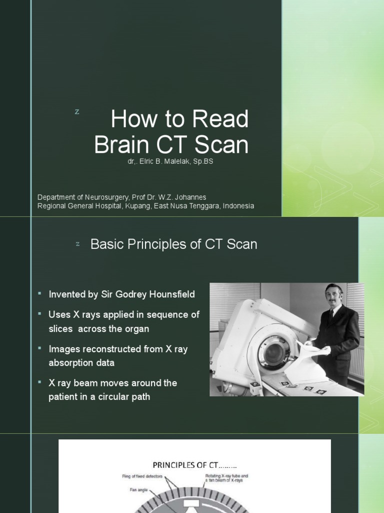How to Read a Brain CT Scan Guide | PDF | Traumatic Brain Injury ...