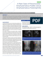 A Rare Case of Pneumoureter Emphysematous Pyelitis Versus Emphysematous Pyelonephritis