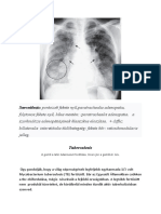 Sarcoidozis: Pontozott Fekete Nyíl, Paratrachealis Adenopatia