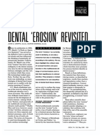 Dental Erosion Revisited