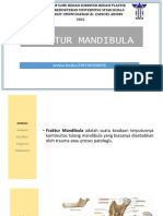 Minggu I - Annisa Amalia - Bedah Plastik - Fraktur Mandibula