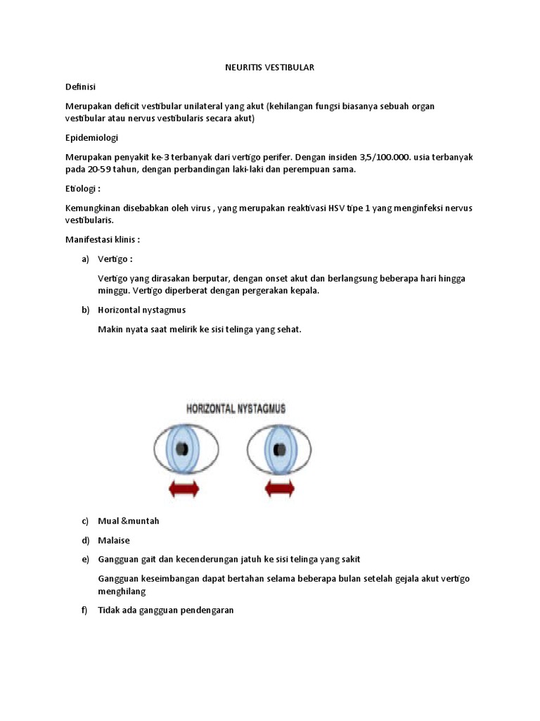 Mengobati Vertigo Akut yang Disebabkan oleh Infeksi Nervus Vestibularis