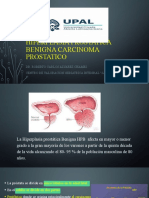 Hiperplasia Prostatica Benigna Carcinoma Prostatico