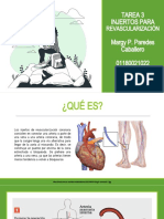 Tarea3 Tipos de Injertos para Revascularizacion