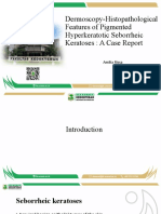 Dermoscopy-Histopathological Features of Pigmented Hyperkeratotic Seborrheic Keratoses