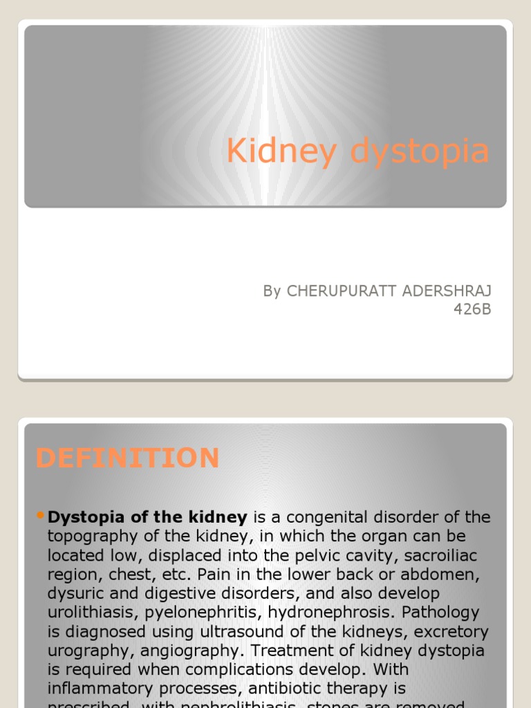 Kidney Dystopia: A Clinical Overview | PDF | Kidney | Pelvis