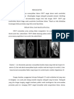 CBCT Memainkan Peran Penting Dalam Analisis Jinak