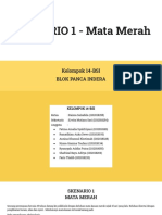PBL Kelompok 14-BSI Skenario 1 Blok Panca Indera