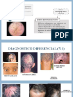 Alopecia Areata 2a Parte