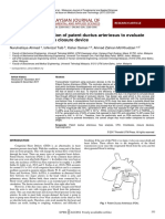 Pulsatile Flow Simulation of Patent Ductus Arterio