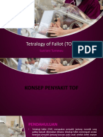 Tetralogy of Fallot (TOF)