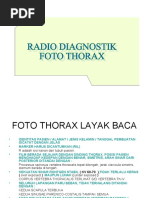 Shuning uchun azo qiyshiq