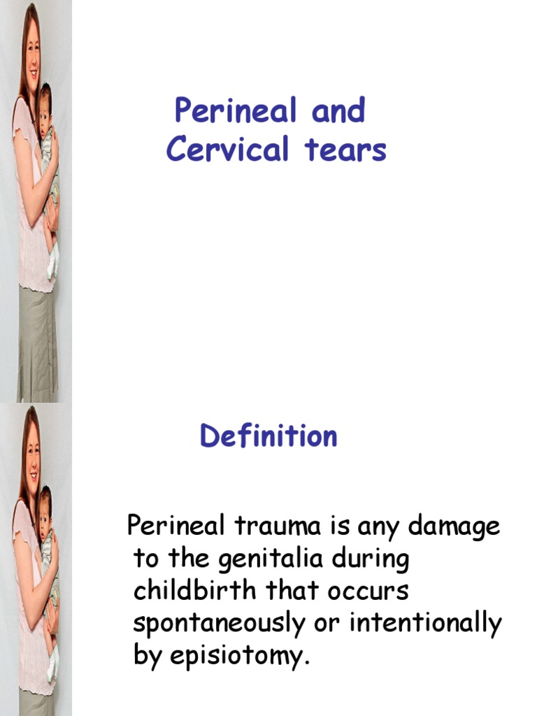 Is It Common To Have Perineal Tears During Childbirth? – EHTN