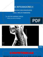 Mielitis Transversa