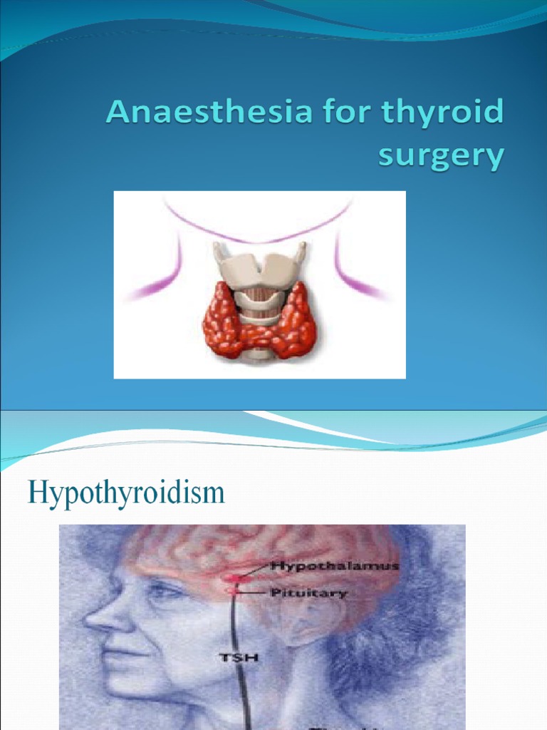 Anaesthesia For Thyroid Surgery.... PDF Hyperthyroidism