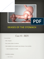Deases of The Stomach