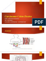 Carcinoma Colon Dextra