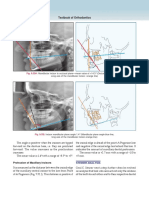 Textbook of Orthodontics: Fig. 9.32H