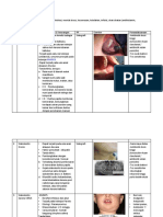 Rangkuman KJLRM Osce Kelainan Kelenjar Saliva