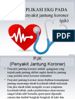 Aplikasi Ekg Pada Penyakit Jantung Koroner (PJK)