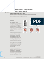 Open Staghorn Stone Surgery