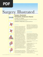 Pyeloplasty (Anderson-Hynes)