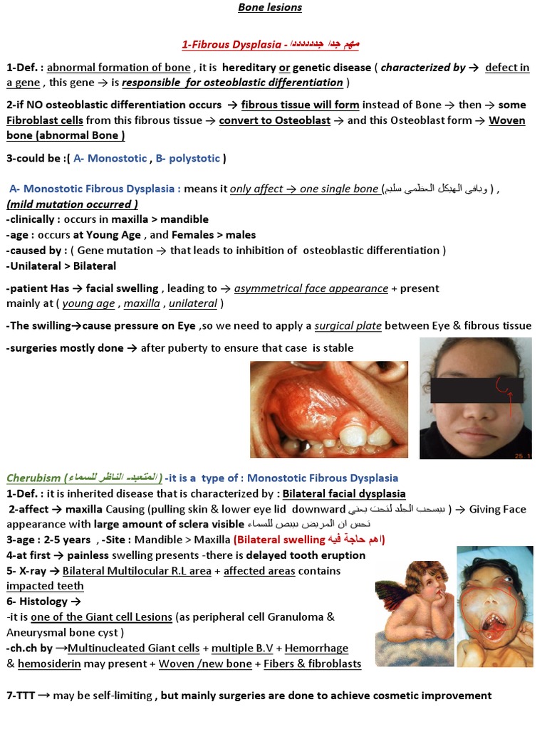 Understanding Common Bone Lesions A Comprehensive Review of Fibrous