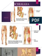 ISCHIALGIA SGD 9