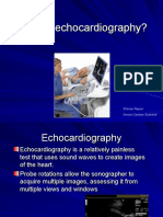 What Is Echocardiography