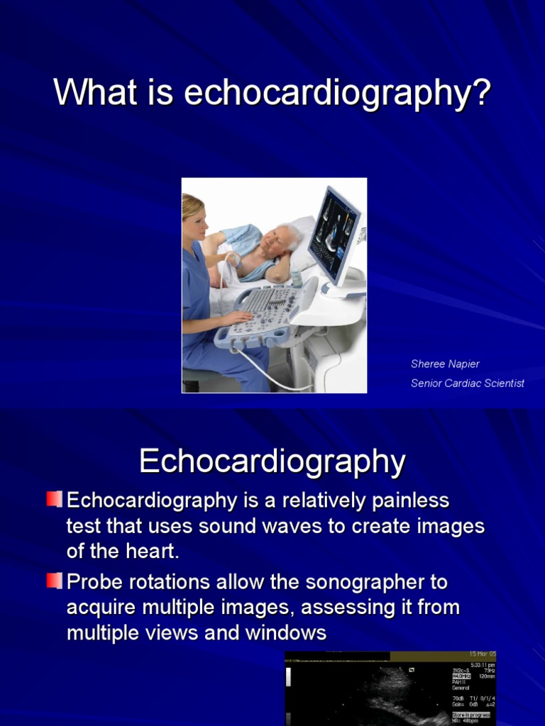 What Is Echocardiography PDF Diastole Heart
