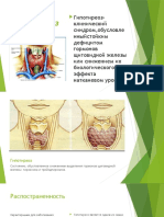 гипотиреоз презентация2715699691784145076