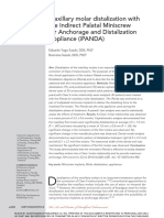 Maxillary Molar Distalization With The Indirect Palatal Miniscrew For Anchorage and Distalization Appliance (iPANDA)