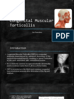 Congenital Muscular Torticollis