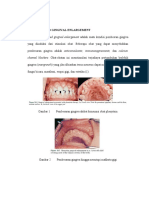 Drug Induced Gingival Enlargement