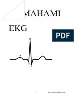 Memahami EKG Kevin Wibawa
