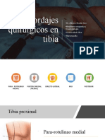 Abordajes de Tibia