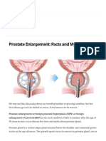 Prostate Enlargement Facts and Myths