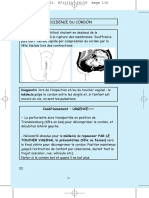 06 Procidence Du Cordon