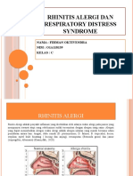 Rhinitis Alergi dan Respiratory Distress Syndrome