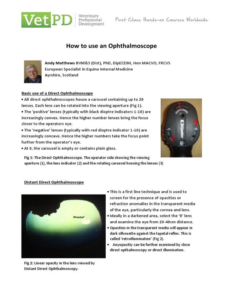 How To Use An Ophthalmoscope Terkunci PDF Eye Aperture