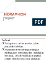 Hidramnion