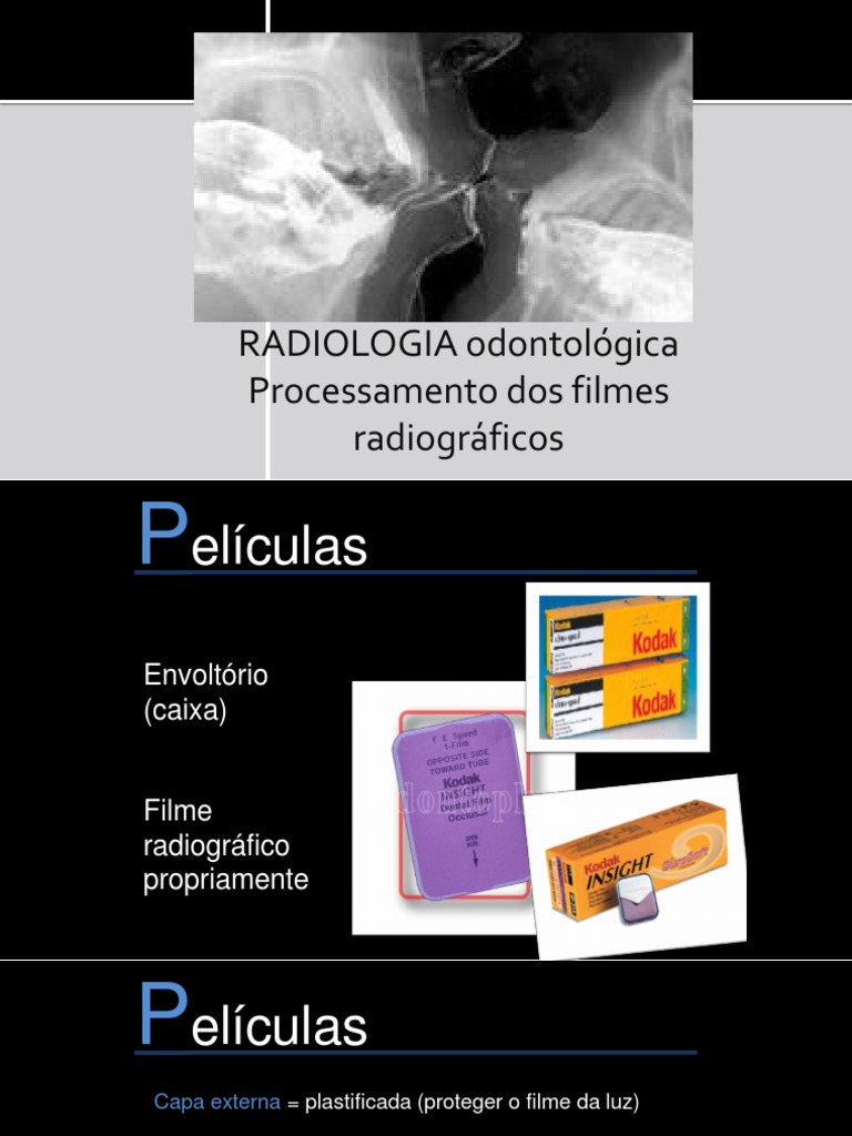 Processamento e Armazenamento de Filmes Radiográficos Odontológicos ...