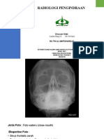 Tugas Radiologi Pengindraan - Kadek Bayu S - 031191044