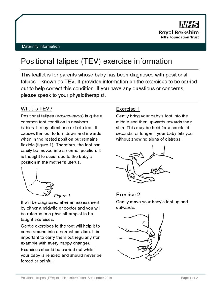 Positional Talipes TEV Exercise Information Sep19 PDF Childbirth