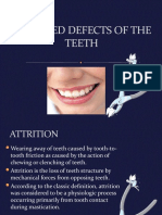 ACQUIRED DEFECTS OF THE TEETH