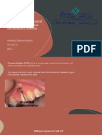 Management of Oral-Antral Communication, Fistula and Maxillary