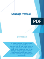 Sondaje Vesical