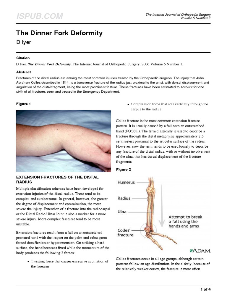 The Dinner Fork Deformity D Iyer PDF Musculoskeletal System
