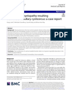 Acute Dorsal Myelopathy Resulting From Intramedullary Cysticercus: A Case Report