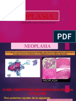 Neoplasia CRITERIOS DE MALIGNIDAD